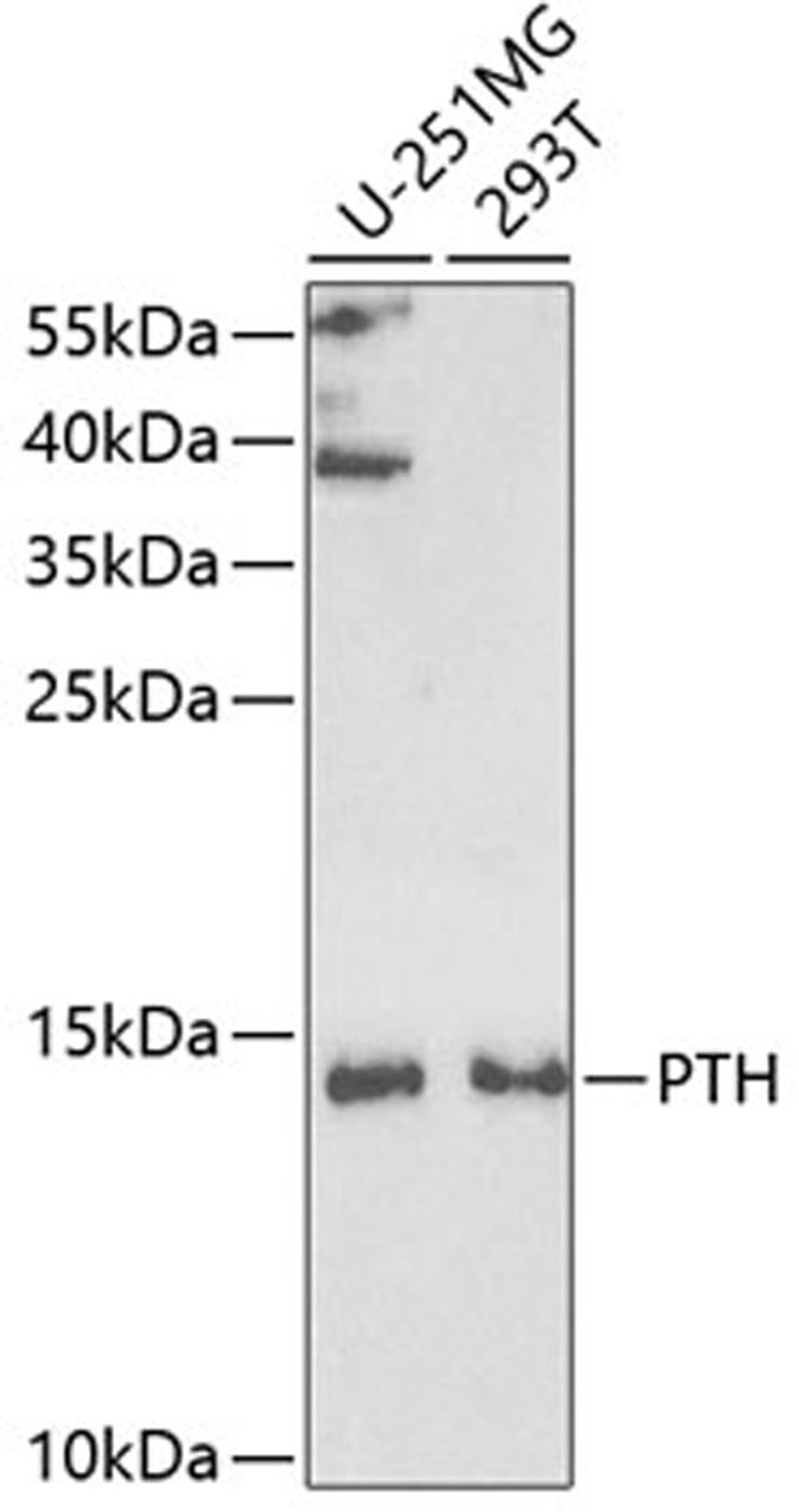 Western blot - PTH antibody (A5846)