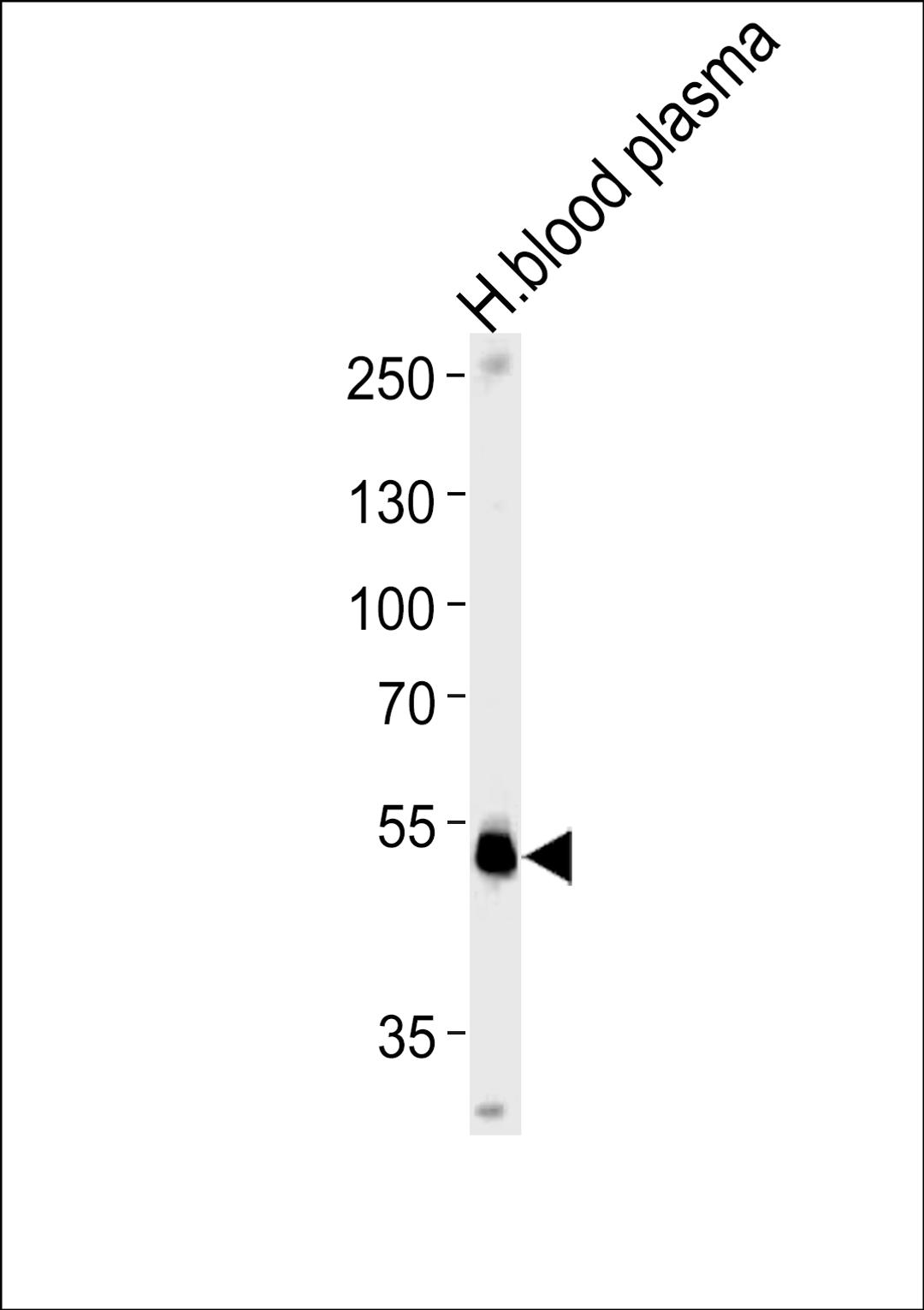 Western blot analysis in human blood plasma tissue lysates (35ug/lane).This demonstrates the SERPINF1 antibody detected the SERPINF1 protein (arrow).