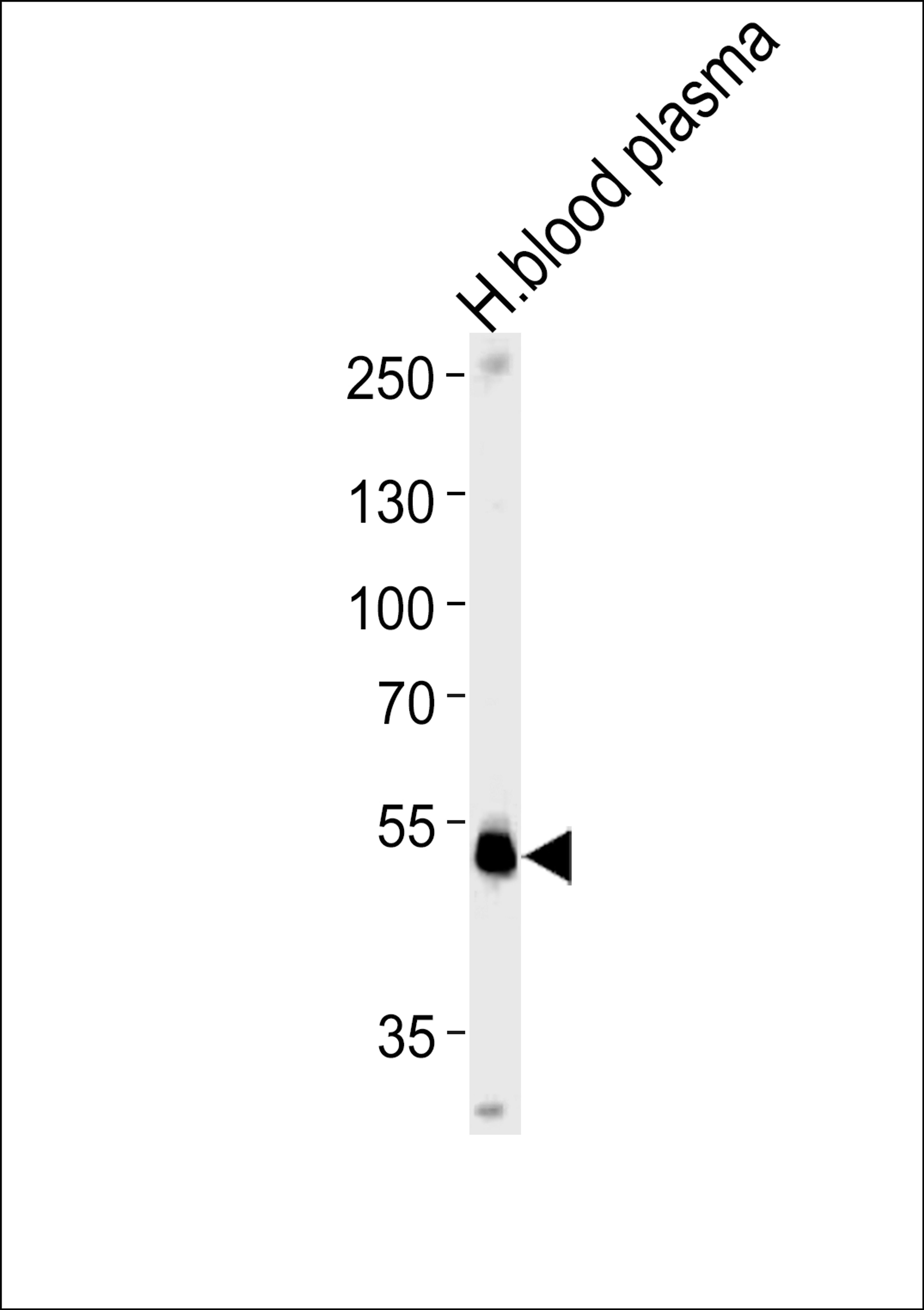 Western blot analysis in human blood plasma tissue lysates (35ug/lane).This demonstrates the SERPINF1 antibody detected the SERPINF1 protein (arrow).