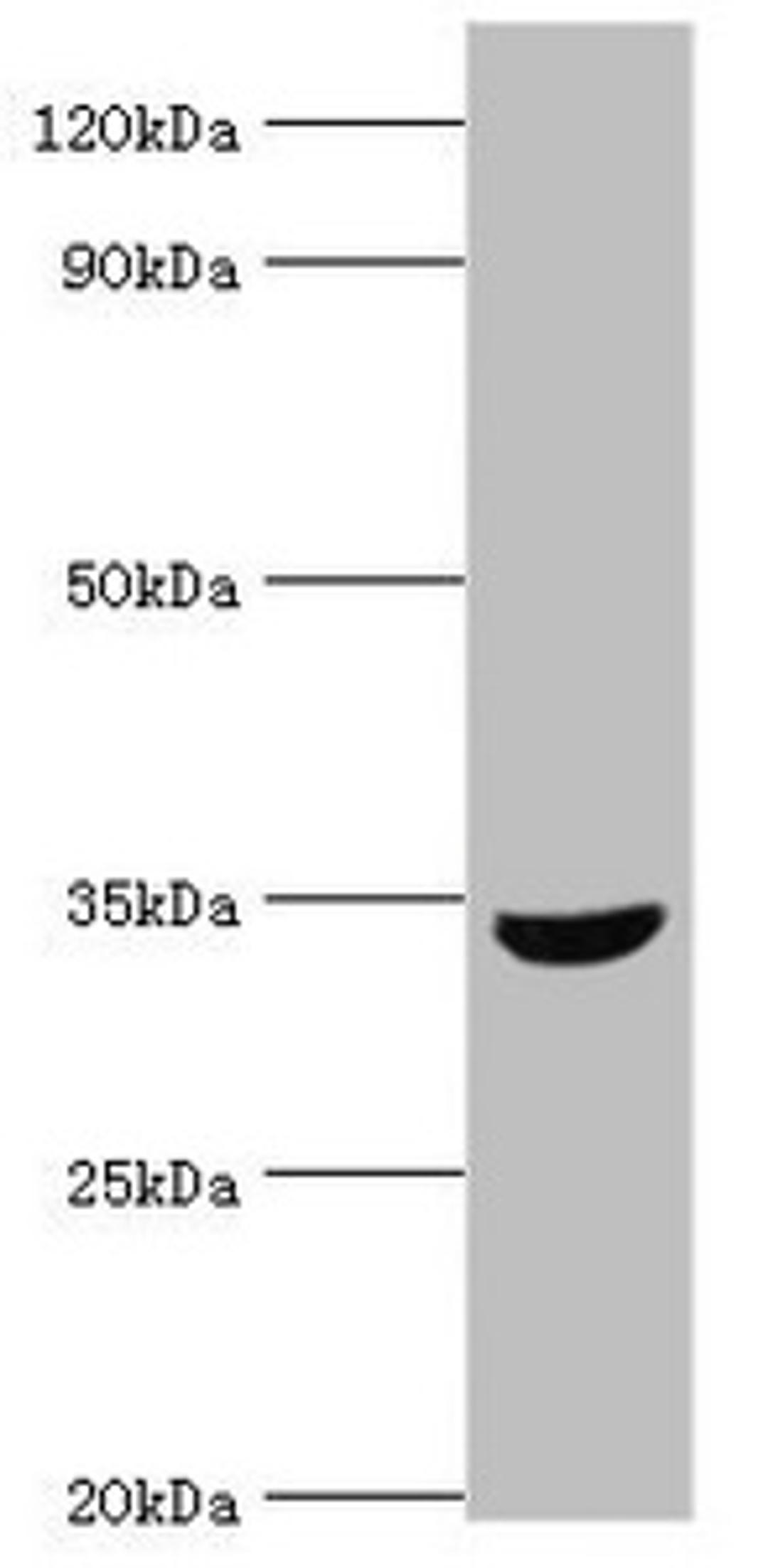 Western blot. All lanes: MSI2 antibody at 10ug/ml + HepG2 whole cell lysate. Secondary. Goat polyclonal to rabbit IgG at 1/10000 dilution. Predicted band size: 36, 29, 18 kDa. Observed band size: 36 kDa. 