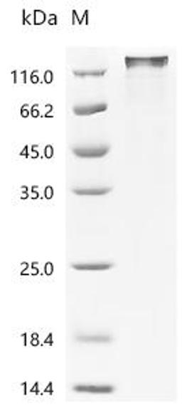 (Tris-Glycine gel) Discontinuous SDS-PAGE (reduced) with 5% enrichment gel and 15% separation gel.