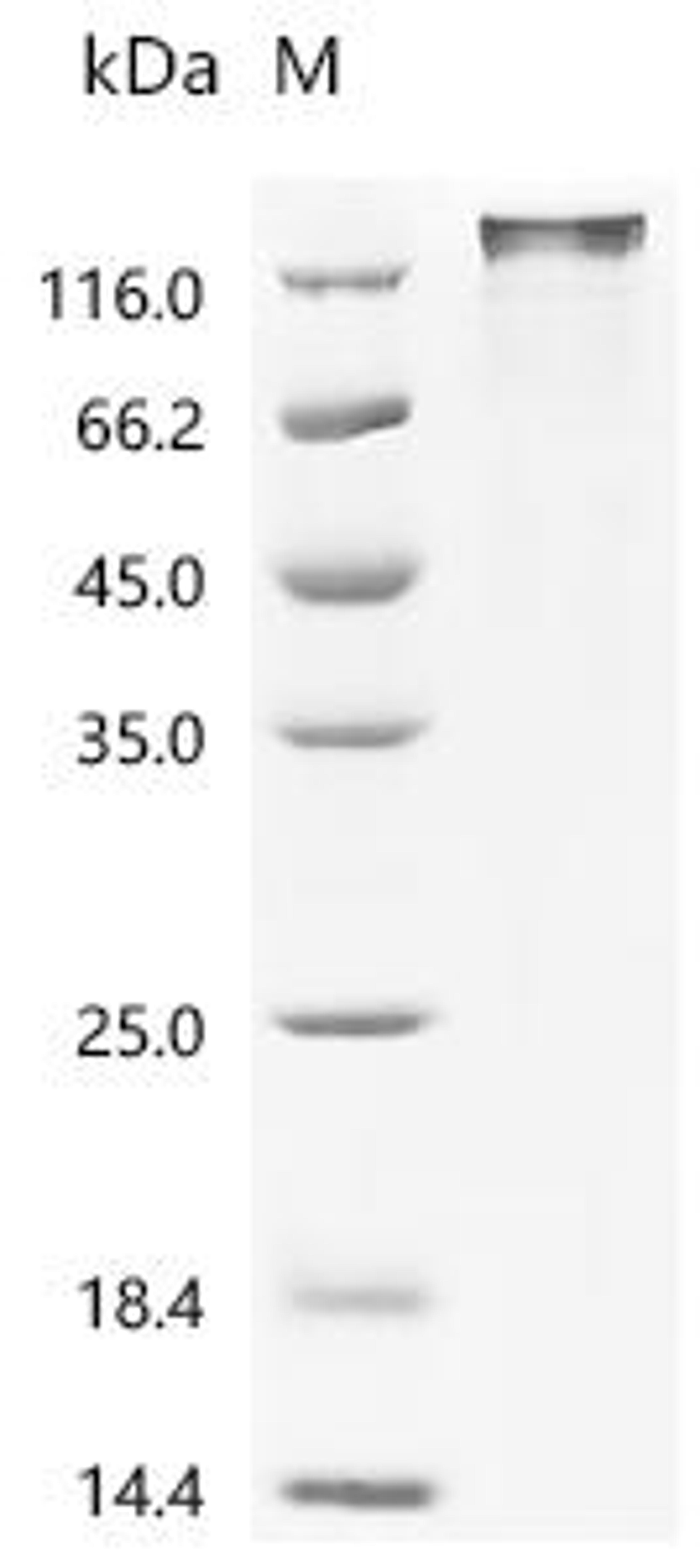 (Tris-Glycine gel) Discontinuous SDS-PAGE (reduced) with 5% enrichment gel and 15% separation gel.