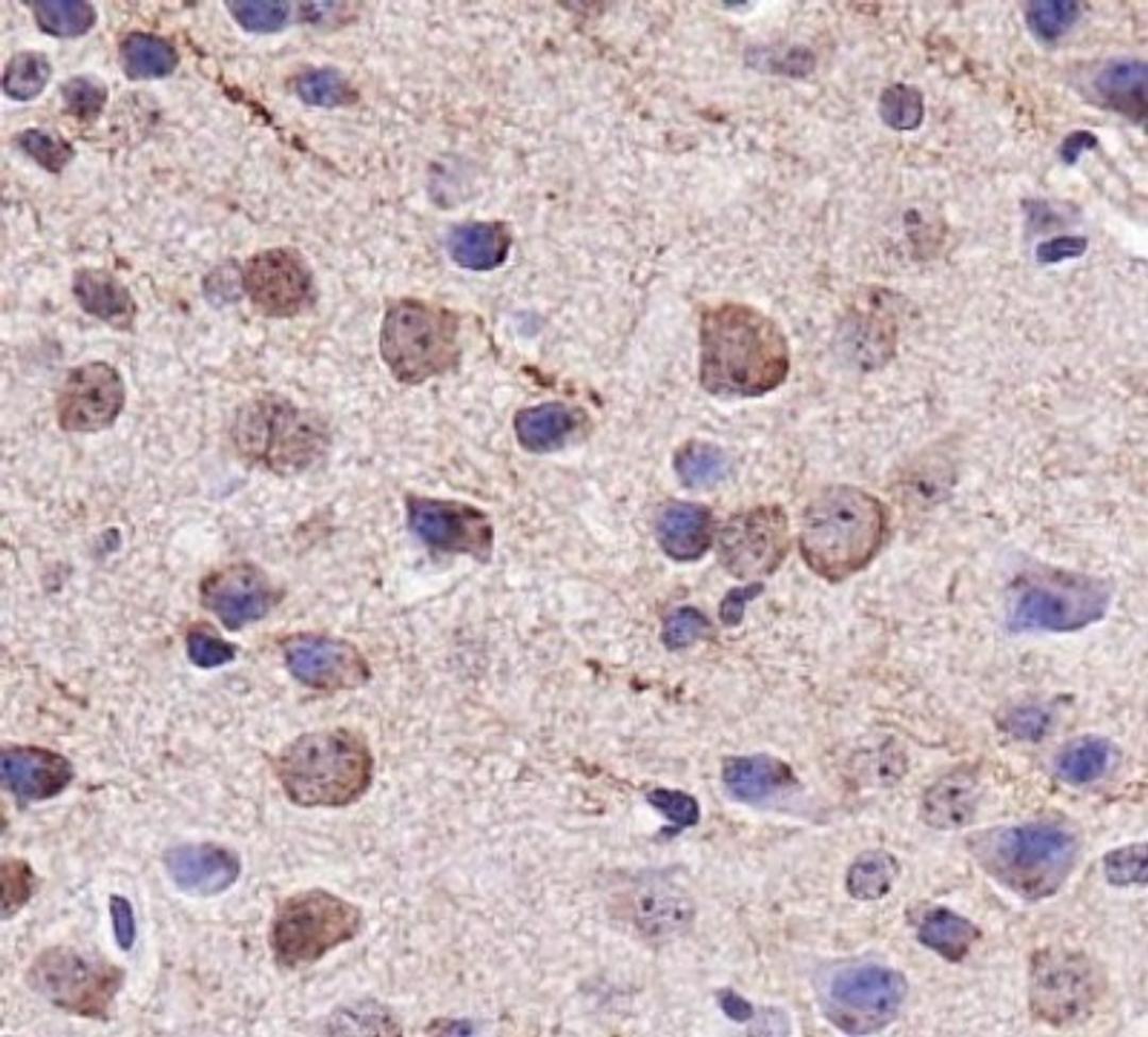 Immunohistochemistry: VMAT2 Antibody [NBP1-69750] - IHC staining of VMAT2 in mouse brain cortex.