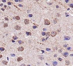 Immunohistochemistry: VMAT2 Antibody [NBP1-69750] - IHC staining of VMAT2 in mouse brain cortex.