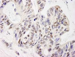 Detection of human ELF1 by immunohistochemistry.