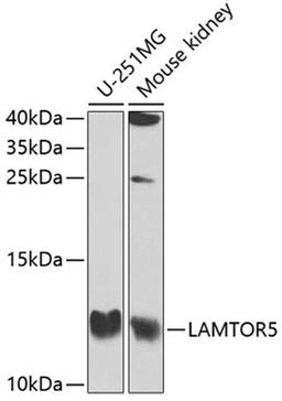 Western blot - LAMTOR5 antibody (A2606)