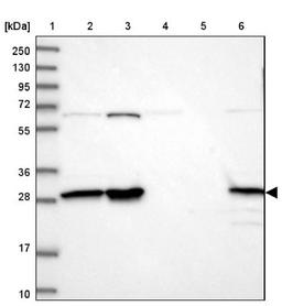 Western Blot: INO80E Antibody [NBP1-86578] - Lane 1: Marker [kDa] 250, 130, 95, 72, 55, 36, 28, 17, 10<br/>Lane 2: Human cell line RT-4<br/>Lane 3: Human cell line U-251MG sp<br/>Lane 4: Human plasma (IgG/HSA depleted)<br/>Lane 5: Human liver tissue<br/>Lane 6: Human tonsil tissue