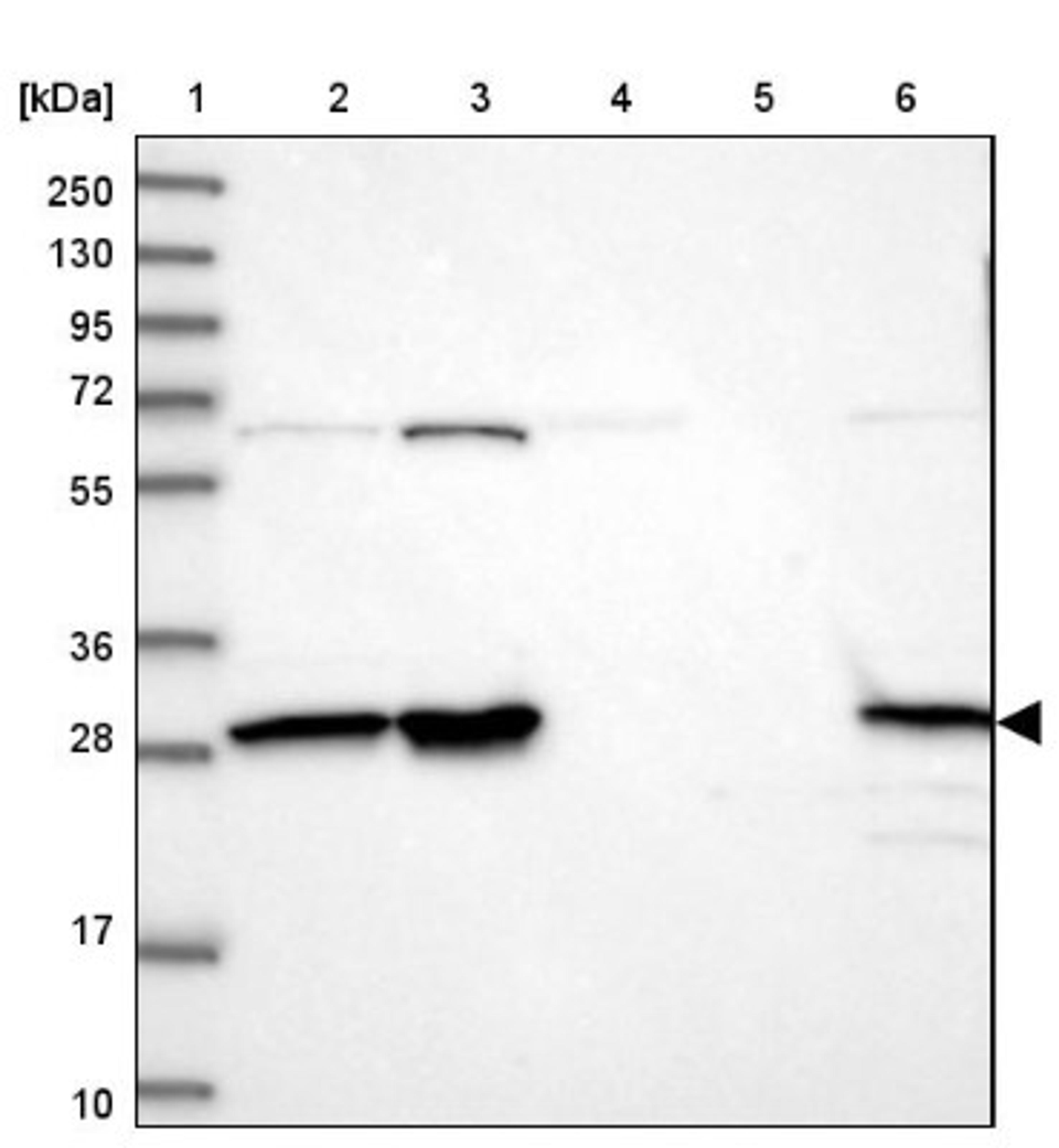 Western Blot: INO80E Antibody [NBP1-86578] - Lane 1: Marker [kDa] 250, 130, 95, 72, 55, 36, 28, 17, 10<br/>Lane 2: Human cell line RT-4<br/>Lane 3: Human cell line U-251MG sp<br/>Lane 4: Human plasma (IgG/HSA depleted)<br/>Lane 5: Human liver tissue<br/>Lane 6: Human tonsil tissue