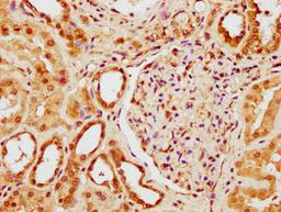 IHC image of CSB-PA884488LA01HU diluted at 1:300 and staining in paraffin-embedded human kidney tissue performed on a Leica BondTM system. After dewaxing and hydration, antigen retrieval was mediated by high pressure in a citrate buffer (pH 6.0). Section was blocked with 10% normal goat serum 30min at RT. Then primary antibody (1% BSA) was incubated at 4°C overnight. The primary is detected by a biotinylated secondary antibody and visualized using an HRP conjugated SP system.