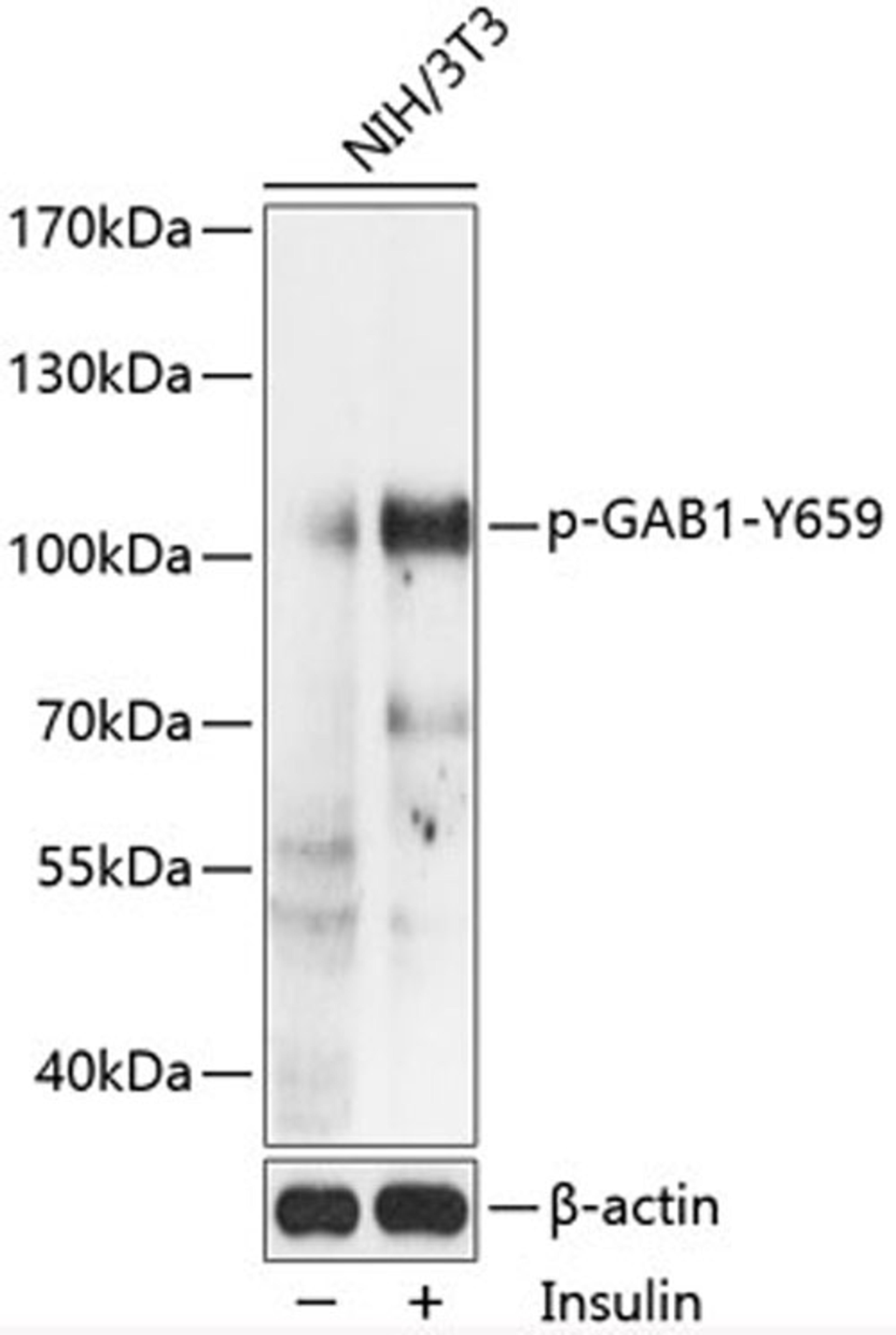 Western blot - Phospho-GAB1-Y659 antibody (AP0774)