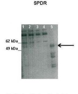 Western Blot: SDPR Antibody [NBP1-74112] - Lanes: Lane1 : 50 ug human placental tissue lysate Lane2: 40 ug human placental tissue lysate Lane3: 30 ug human placental tissue lysate Lane4: 20 ug human placental tissue lysate Lane5: 20 ug human myometrial tissue lysate Primary, Antibody Dilution: 1 : 500 Secondary Antibody: Goat anti-rabbit HRP Secondary, Antibody Dilution: 1 : 10000 Gene name: SDPR.