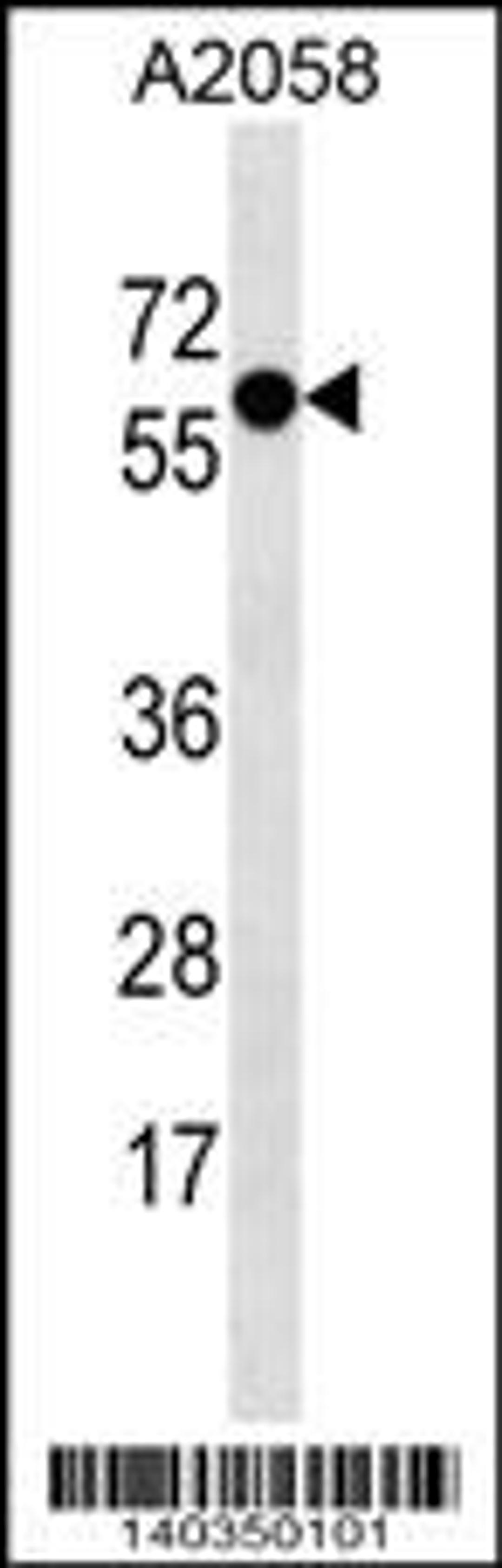 Western blot analysis in A2058 cell line lysates (35ug/lane).