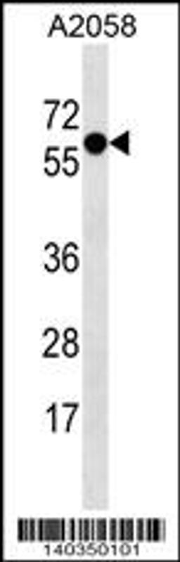 Western blot analysis in A2058 cell line lysates (35ug/lane).