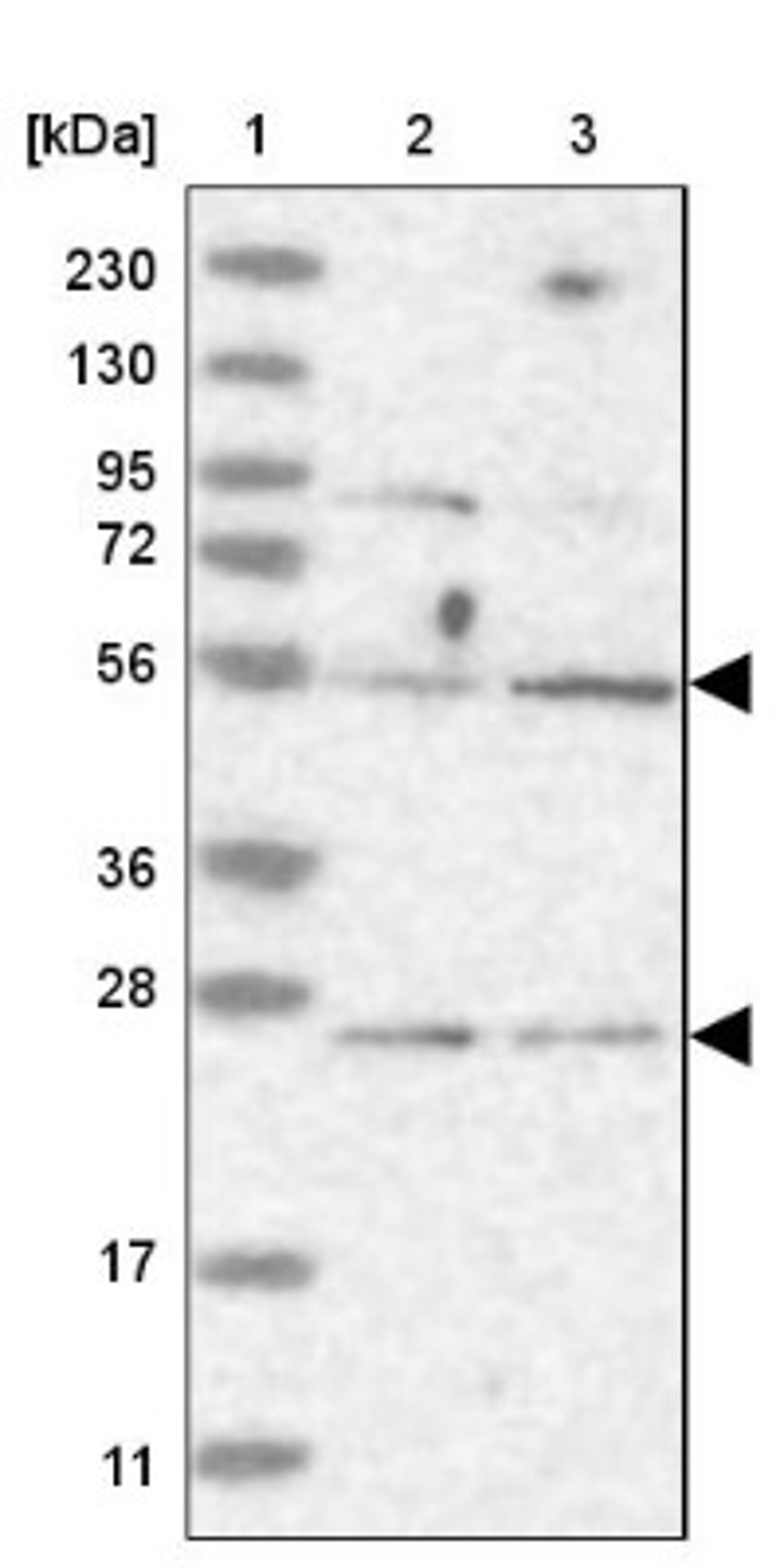 Western Blot: CEP57 Antibody [NBP1-83045] - Lane 1: Marker [kDa] 230, 130, 95, 72, 56, 36, 28, 17, 11<br/>Lane 2: Human cell line RT-4<br/>Lane 3: Human cell line U-251MG sp