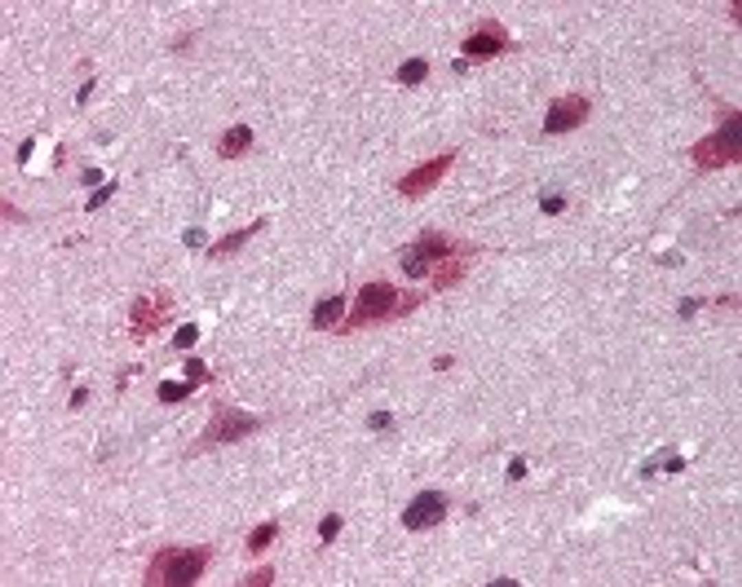 Immunohistochemistry staining of TNIP2 in brain cortex tissue using TNIP2 Antibody.