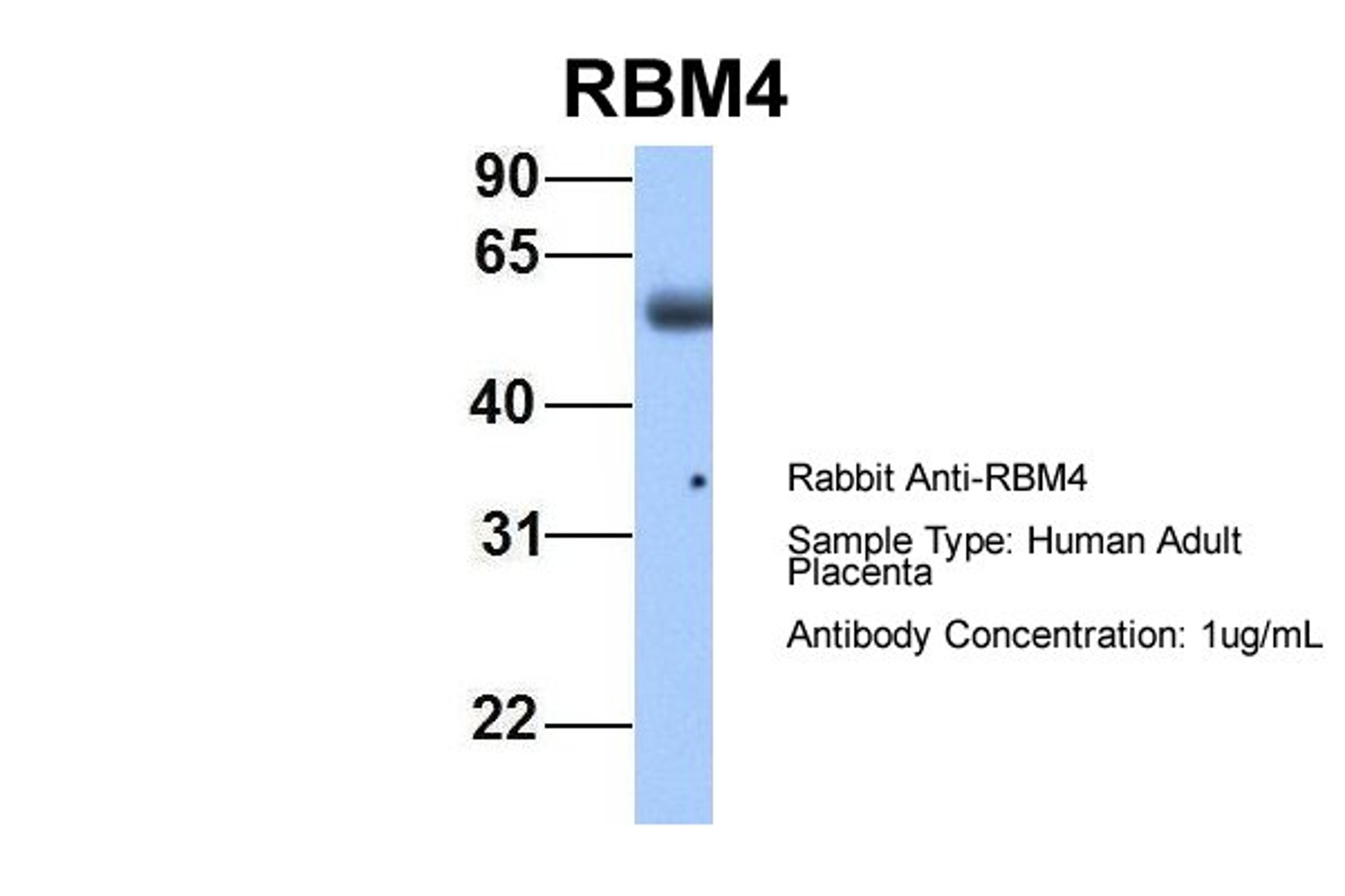 Antibody used in WB on Hum. Adult Placenta at 1 ug/ml.