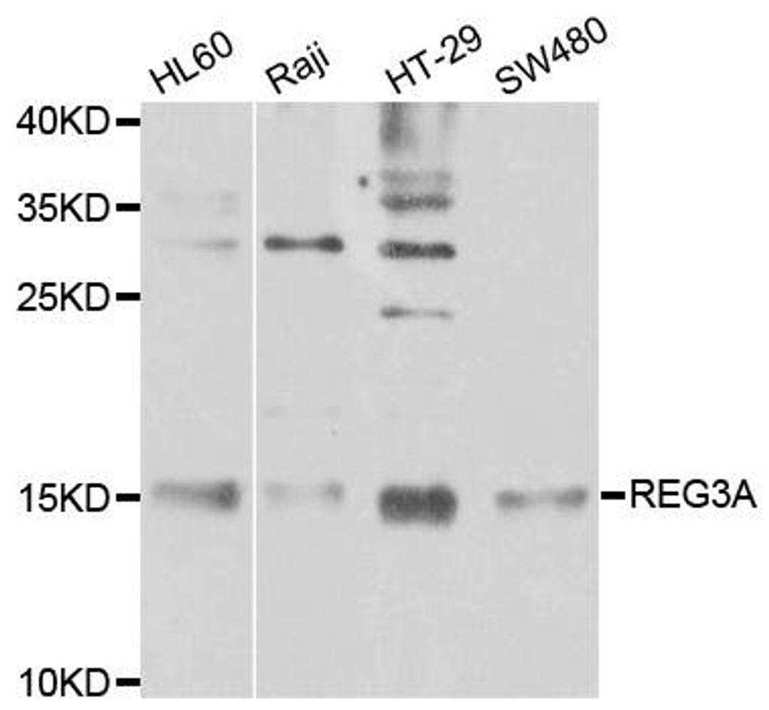 Western blot analysis of extracts of various cell lines using REG3A antibody