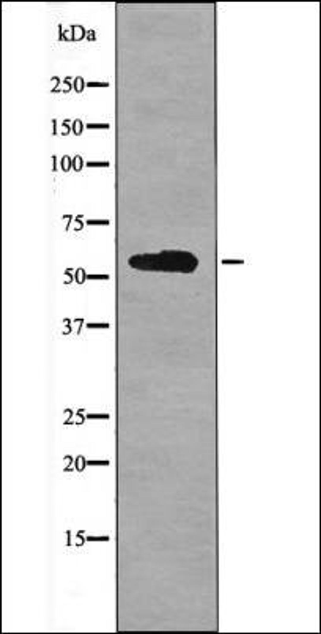 Western blot analysis of HeLa whole cell lysates using BACE -Phospho-Ser498- antibody