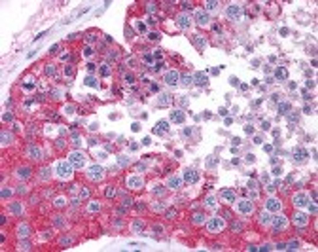 Immunohistochemistry staining of MVP in testis tissue using MVP Antibody.