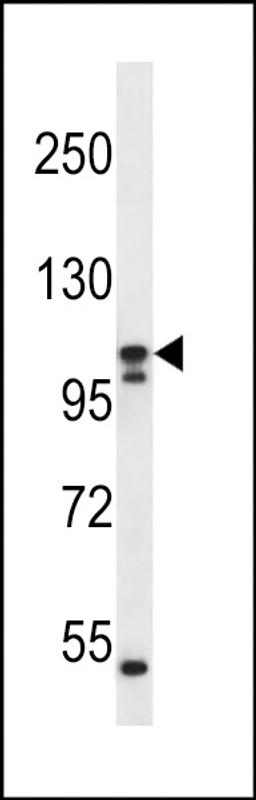 Western blot analysis in ZR-75-1 cell line lysates (35ug/lane).