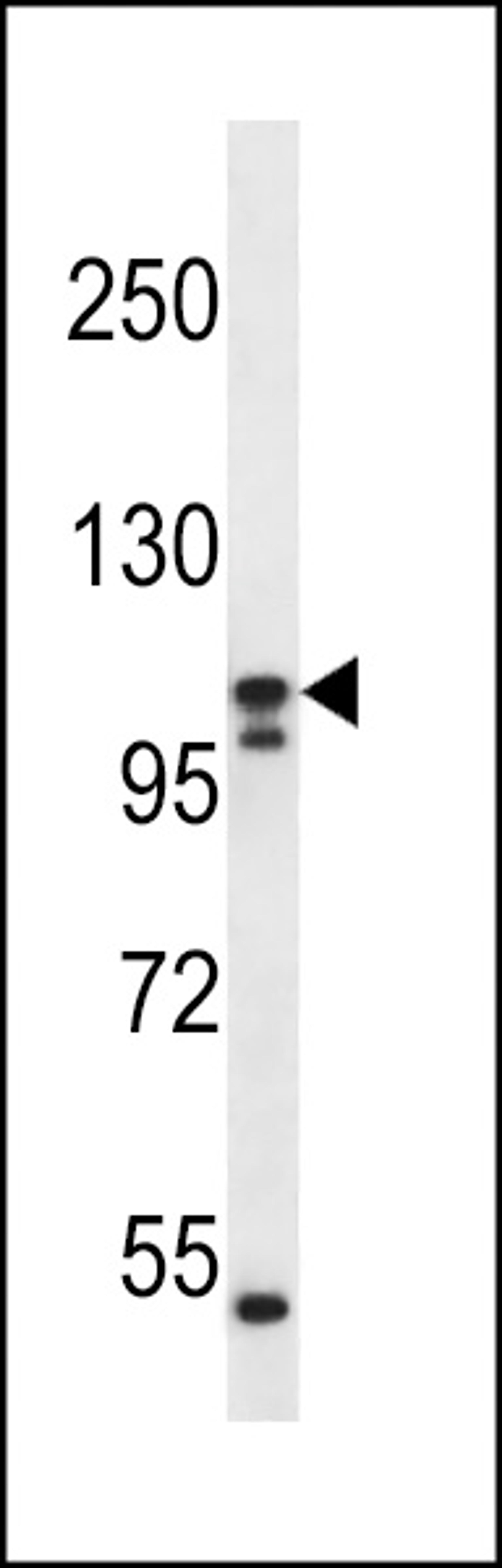 Western blot analysis in ZR-75-1 cell line lysates (35ug/lane).