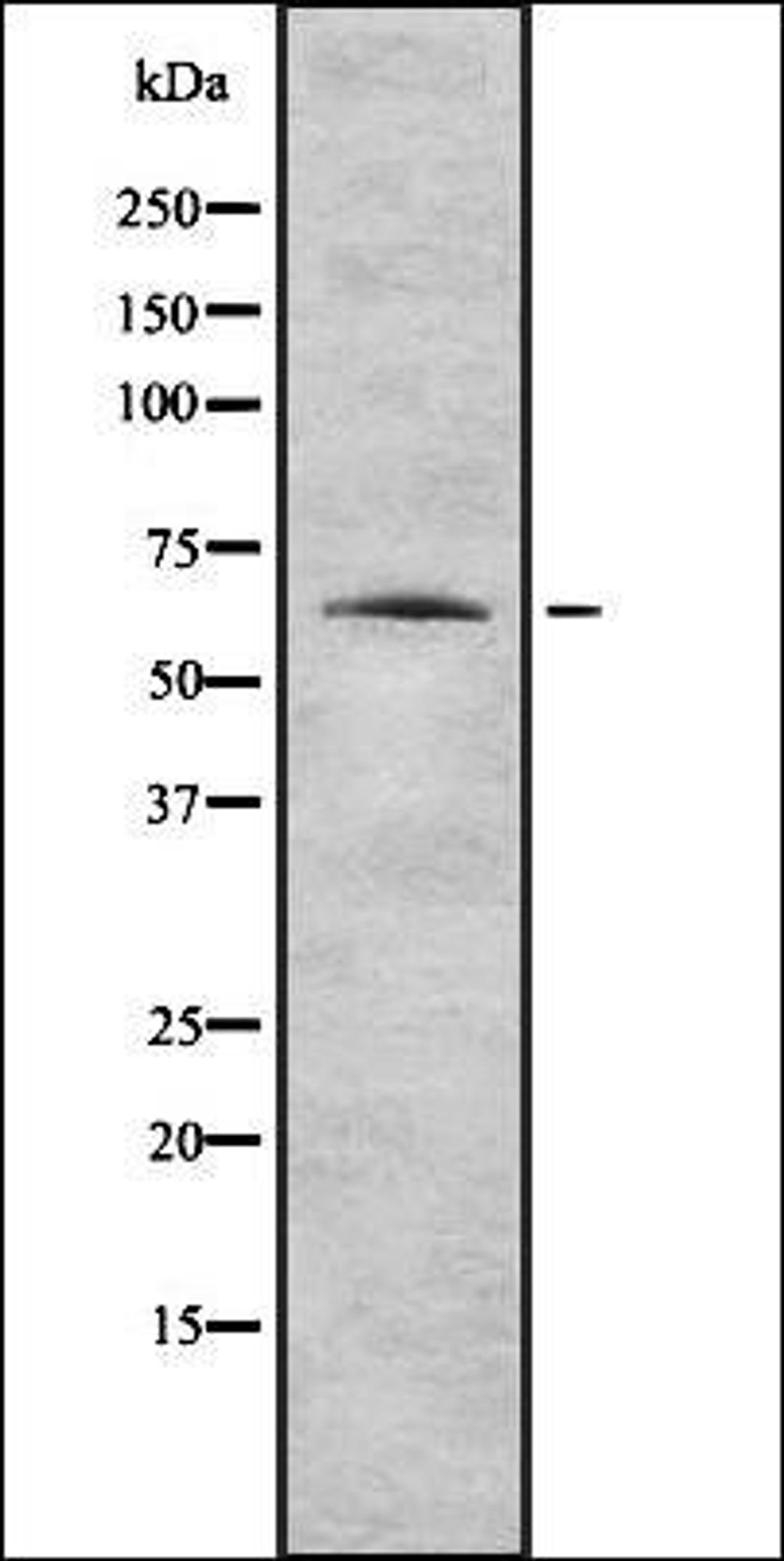 Western blot analysis of HEK293 cells using K2C1 antibody