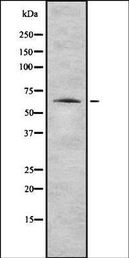 Western blot analysis of HEK293 cells using K2C1 antibody