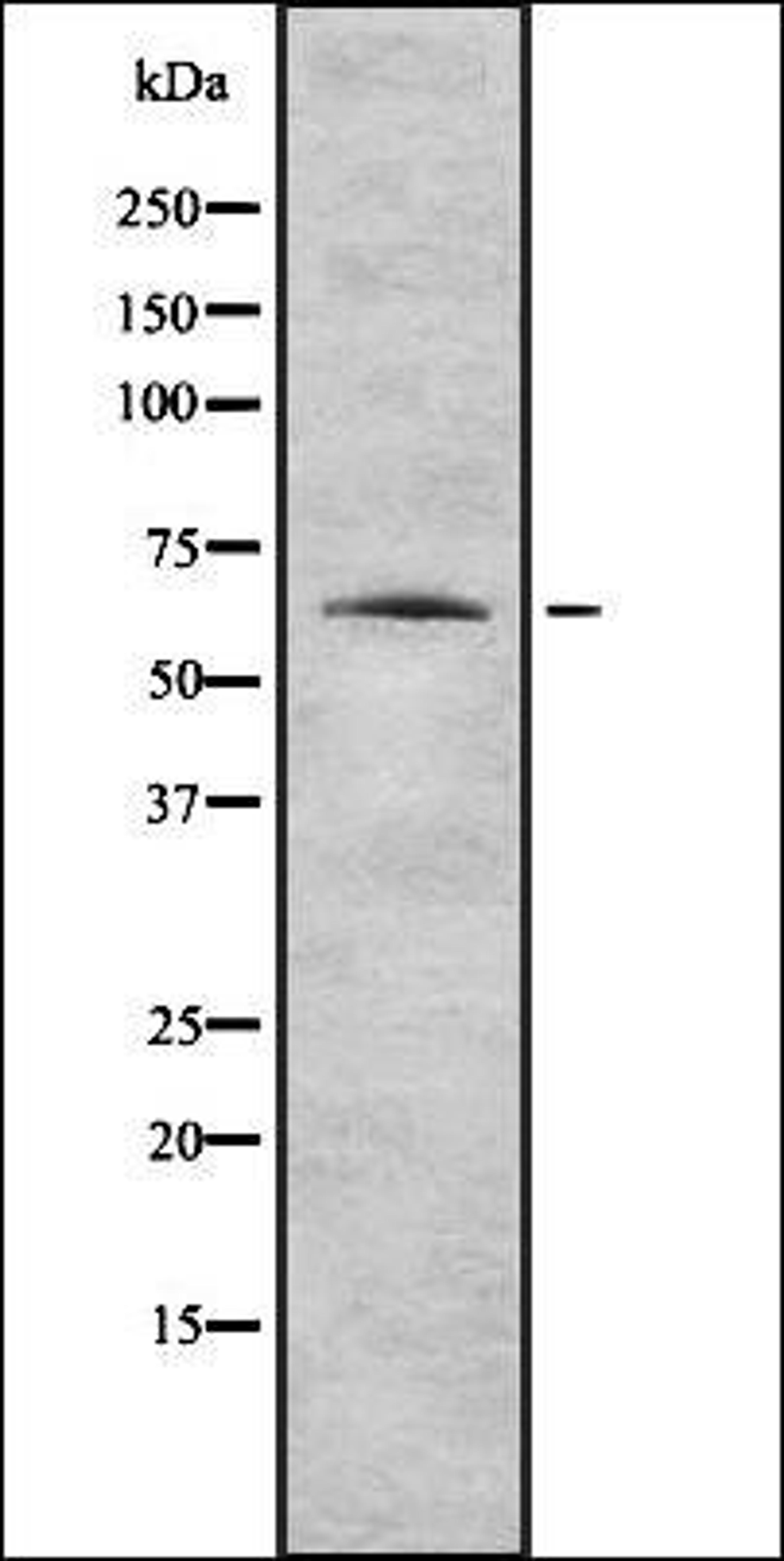 Western blot analysis of HEK293 cells using K2C1 antibody