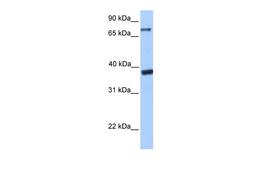 Antibody used in WB on Transfected 293T at 0.2-1 ug/ml.