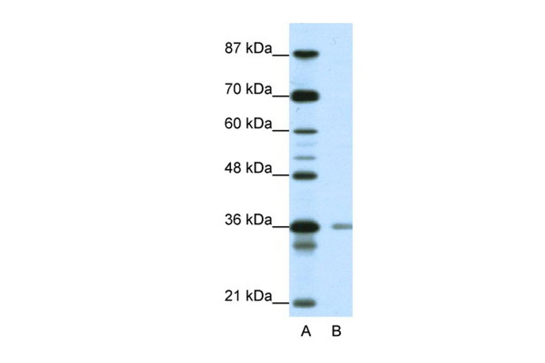 Antibody used in WB on Human Jurkat 0.2-1 ug/ml.