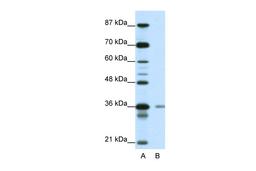 Antibody used in WB on Human Jurkat 0.2-1 ug/ml.