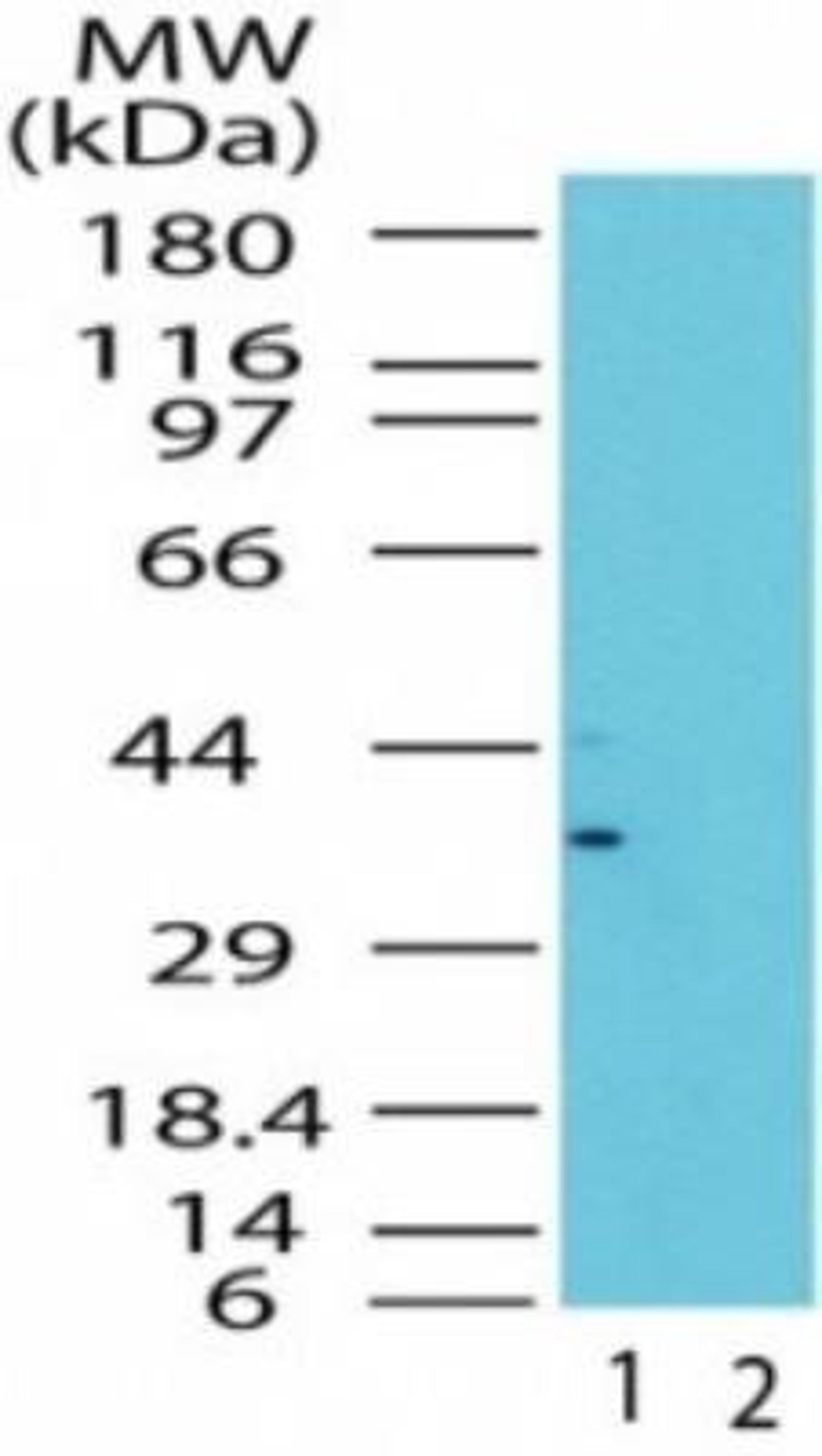 Western Blot: GBL Antibody [NBP2-24705] -  Analysis of LST8 in the 1) absence and 2) presence of immunizing peptide in human brain lysate using NBP2-24705 at 5 ug/ml.