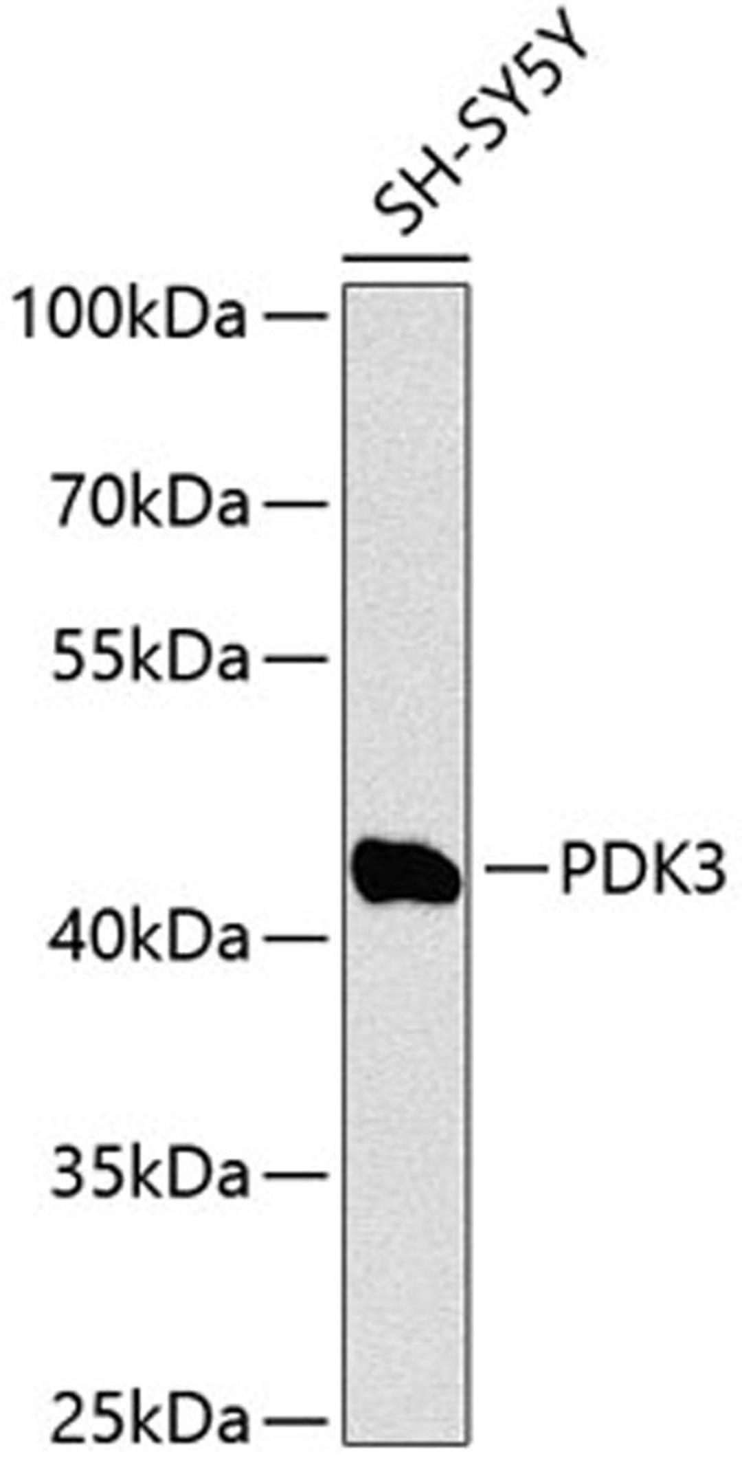 Western blot - PDK3 Antibody (A12480)