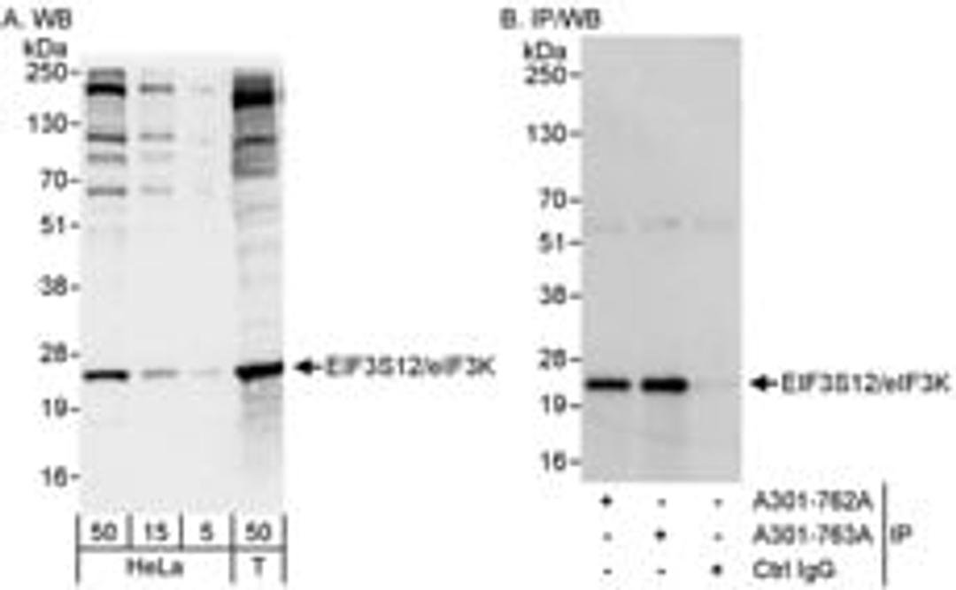 Detection of human eIF3K/EIF3S12 by western blot and immunoprecipitation.