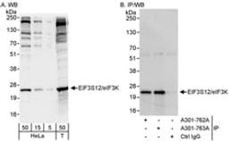 Detection of human eIF3K/EIF3S12 by western blot and immunoprecipitation.