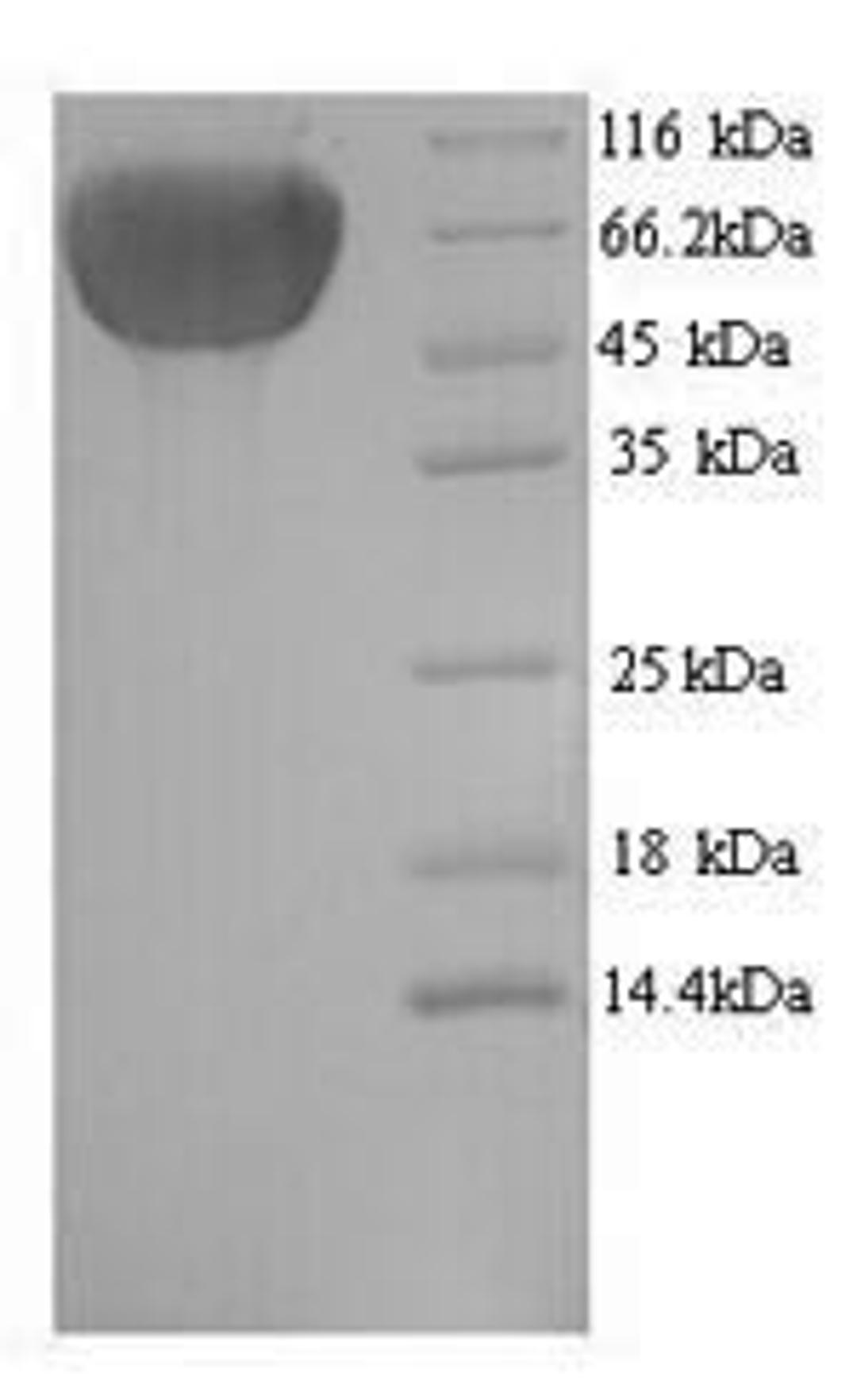 (Tris-Glycine gel) Discontinuous SDS-PAGE (reduced) with 5% enrichment gel and 15% separation gel.