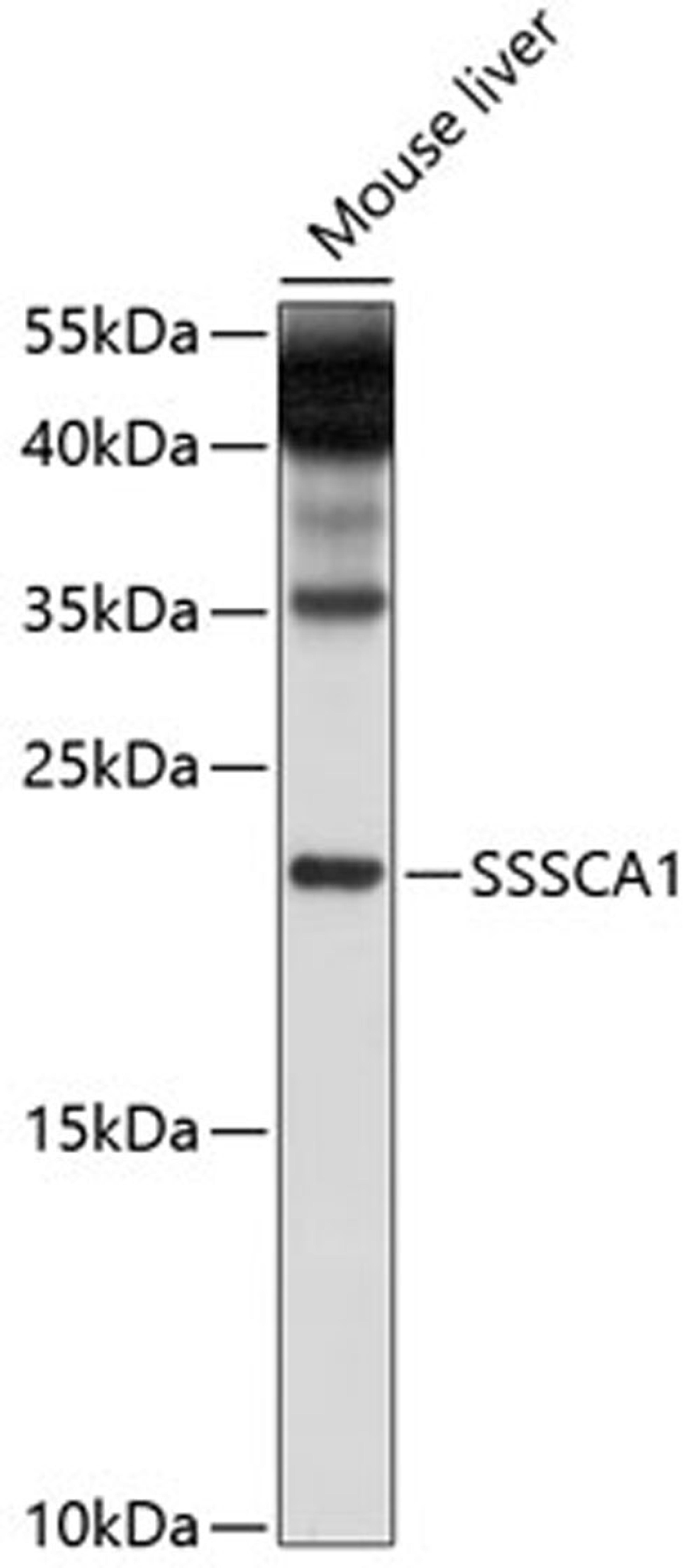 Western blot - SSSCA1 antibody (A10137)