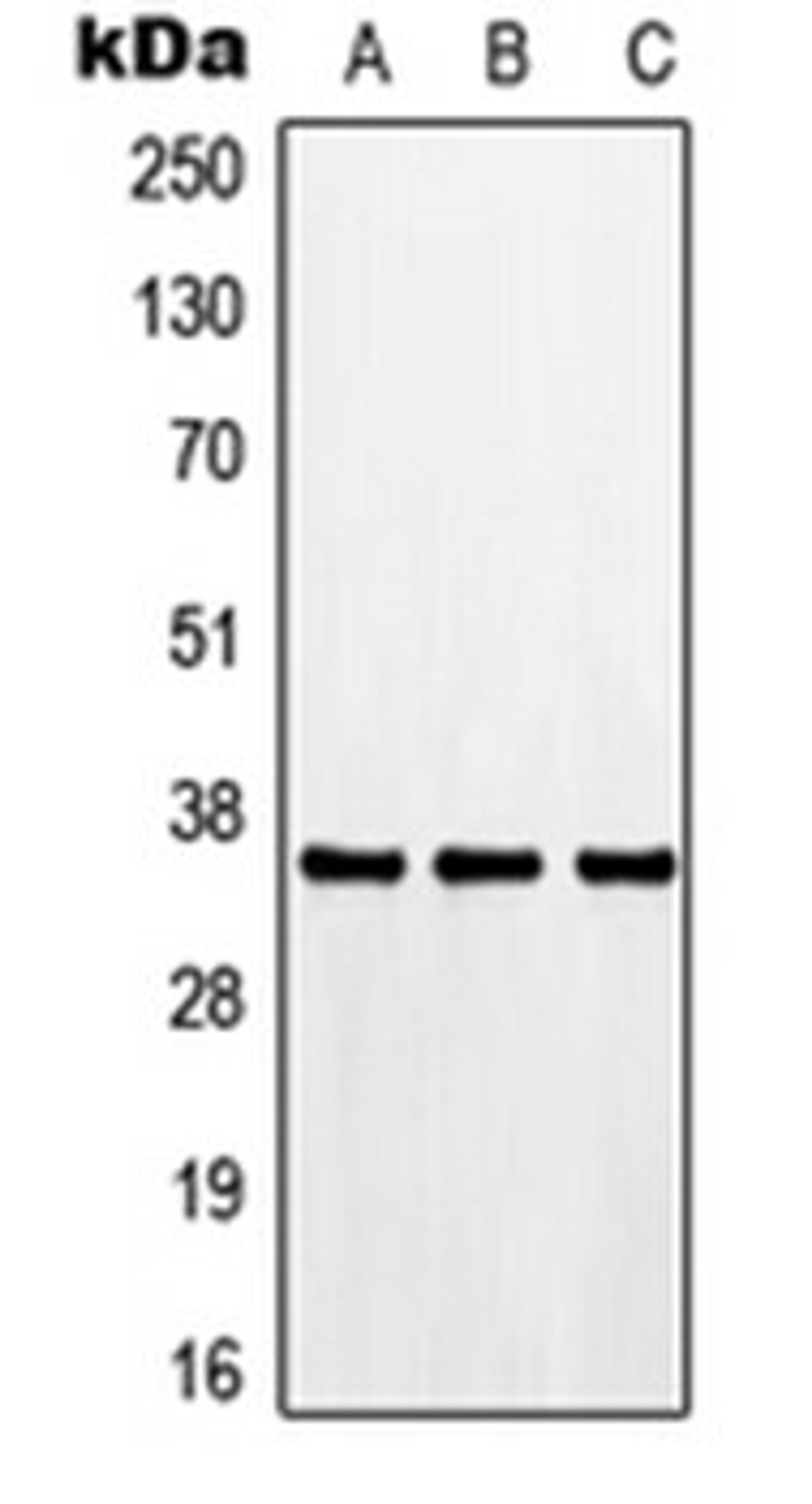 Western blot analysis of HEK293T (Lane 1), Raw264.7 (Lane 2), PC12 (Lane 3) whole cell lysates using CDK3 antibody