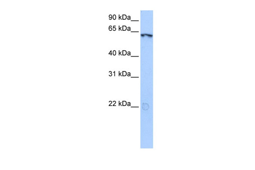 Antibody used in WB on Human HeLa at 0.2-1 ug/ml.