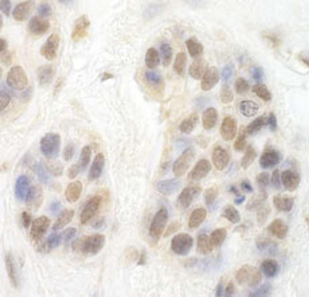 Detection of human CDK8 by immunohistochemistry.