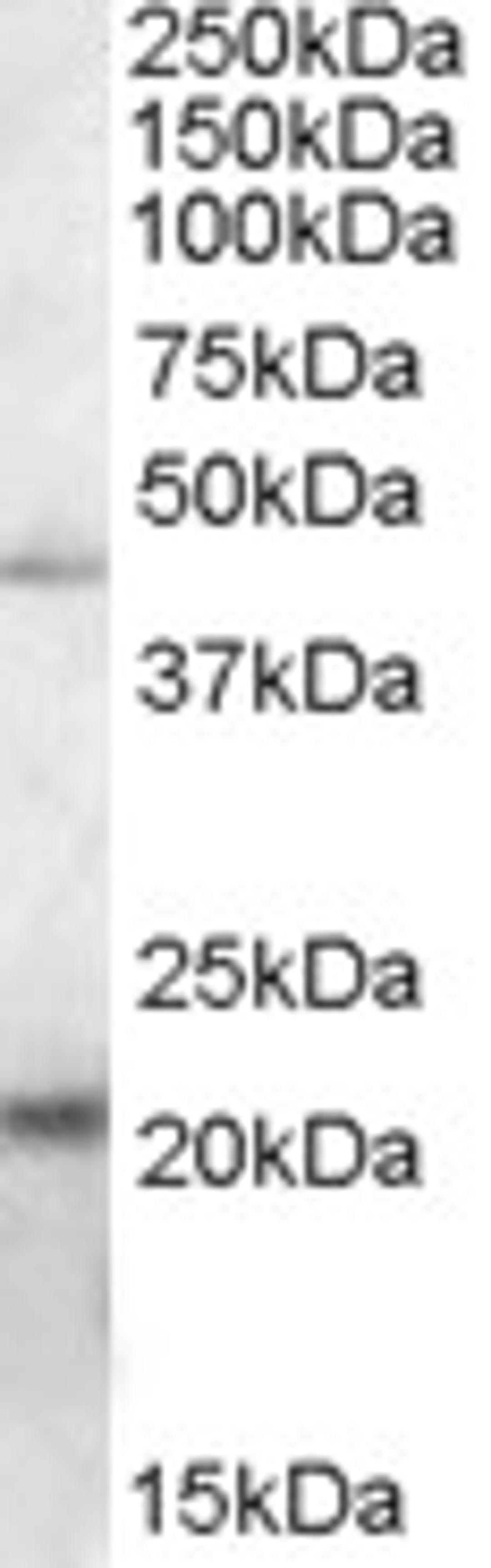 46-542 (0.2ug/ml) staining of K562 lysate (35ug protein in RIPA buffer). Primary incubation was 1 hour. Detected by chemiluminescence.