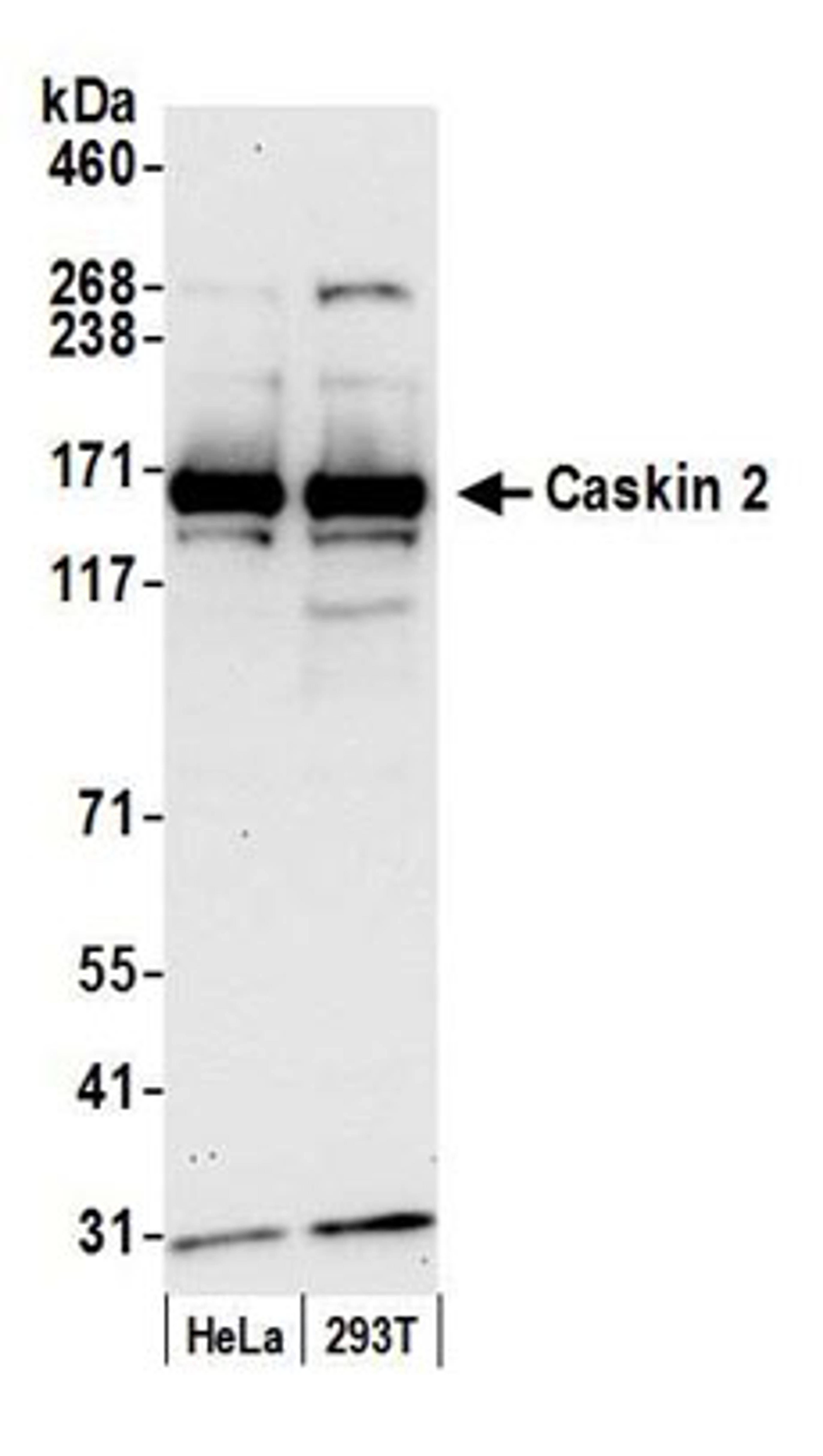 Detection of human Caskin 2 by western blot.