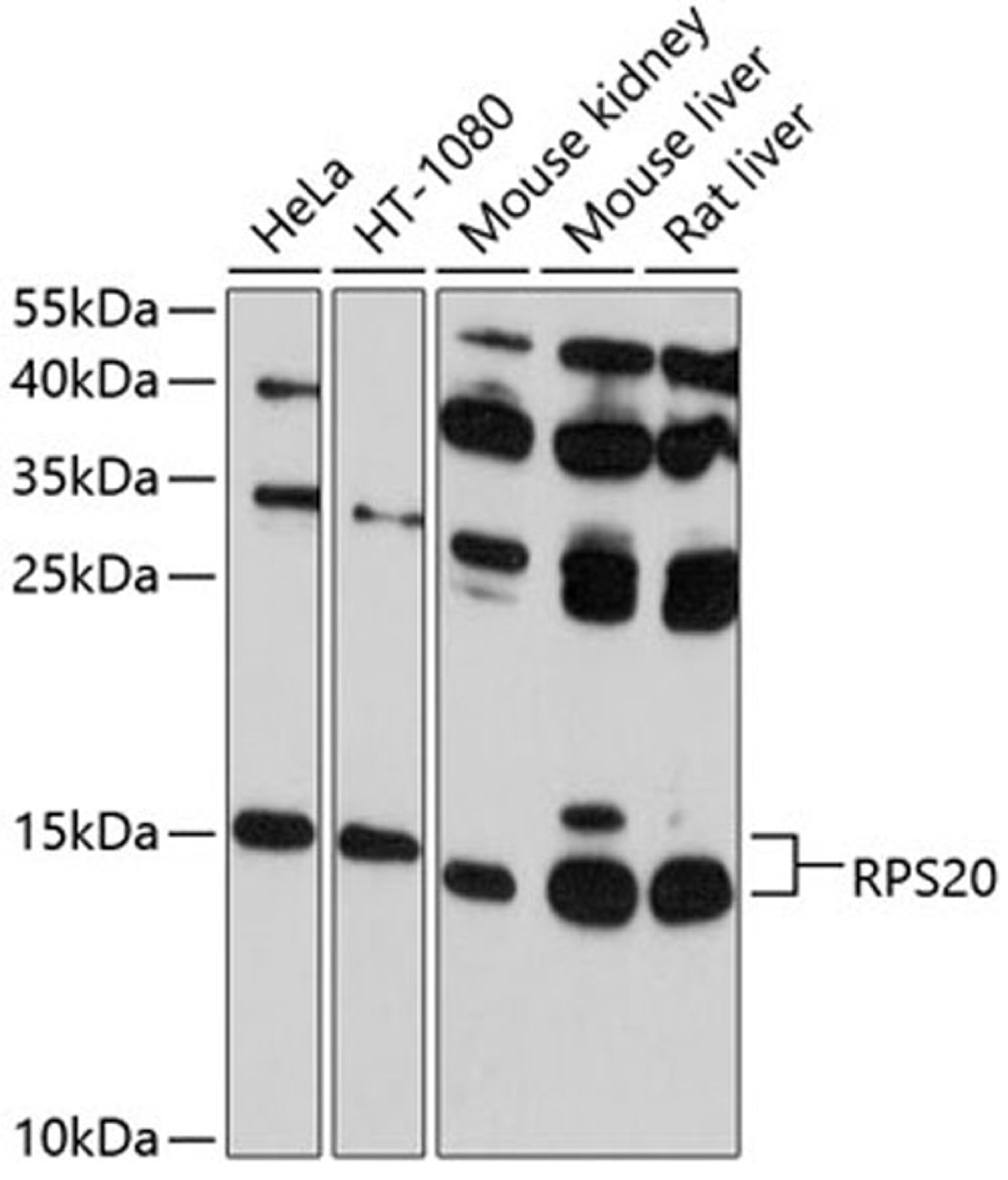 Western blot - RPS20 antibody (A10363)