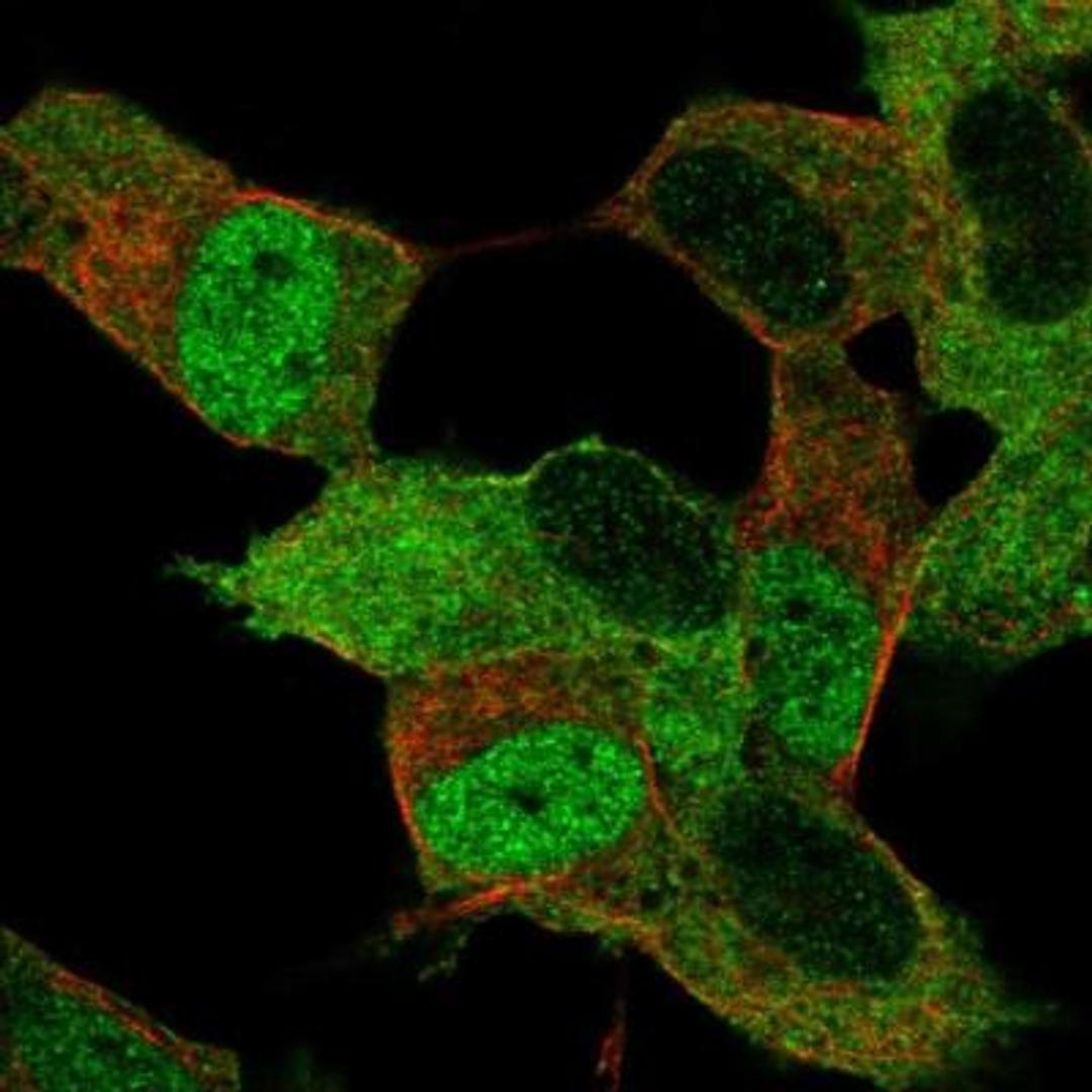 Immunocytochemistry/Immunofluorescence: Myt1 Antibody [NBP1-81021] - ICC-IF analysis of Human cell line SH-SY5Y showing MYT1 positivity in the nuclei and cytoplasm of cells.