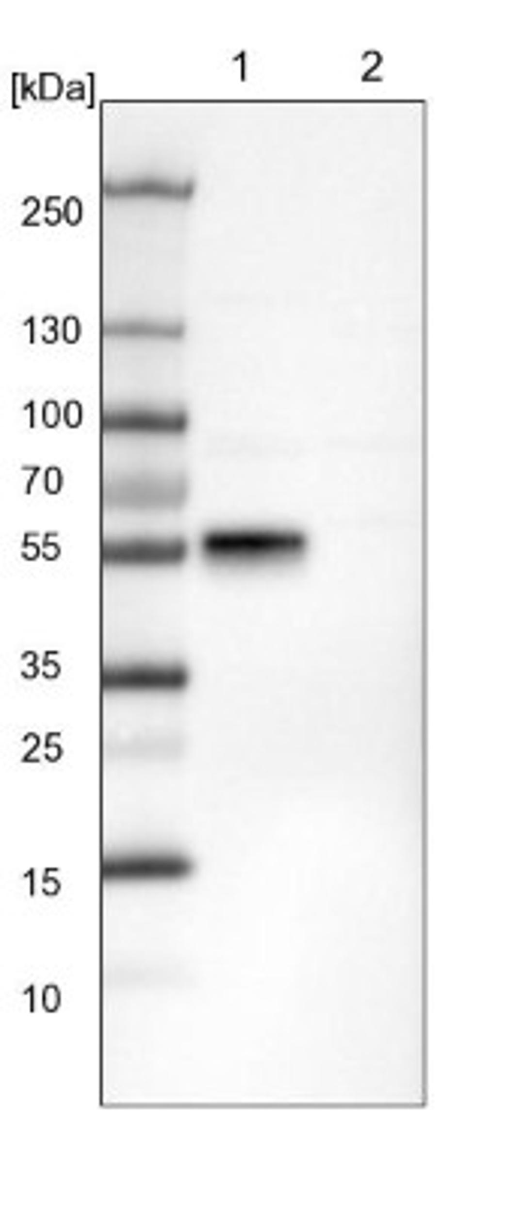 Western Blot: RBMS3 Antibody [NBP1-89497] - Lane 1: NIH-3T3 cell lysate (Mouse embryonic fibroblast cells)<br/>Lane 2: NBT-II cell lysate (Rat Wistar bladder tumour cells)