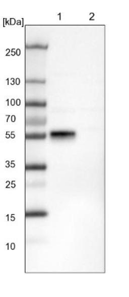 Western Blot: RBMS3 Antibody [NBP1-89497] - Lane 1: NIH-3T3 cell lysate (Mouse embryonic fibroblast cells)<br/>Lane 2: NBT-II cell lysate (Rat Wistar bladder tumour cells)