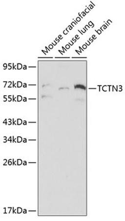 Western blot - TCTN3 antibody (A0684)