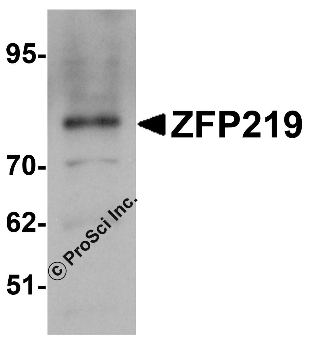 Western blot analysis of ZFP219 in EL4 cell lysate with ZFP219 antibody at 1 μg/mL.