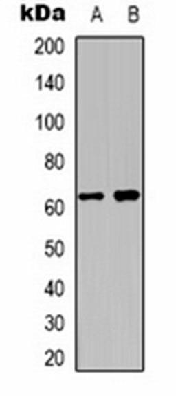 Western blot analysis of  mouse brain (Lane1), rat brain (Lane2) whole cell lysates using Kv8.2 antibody