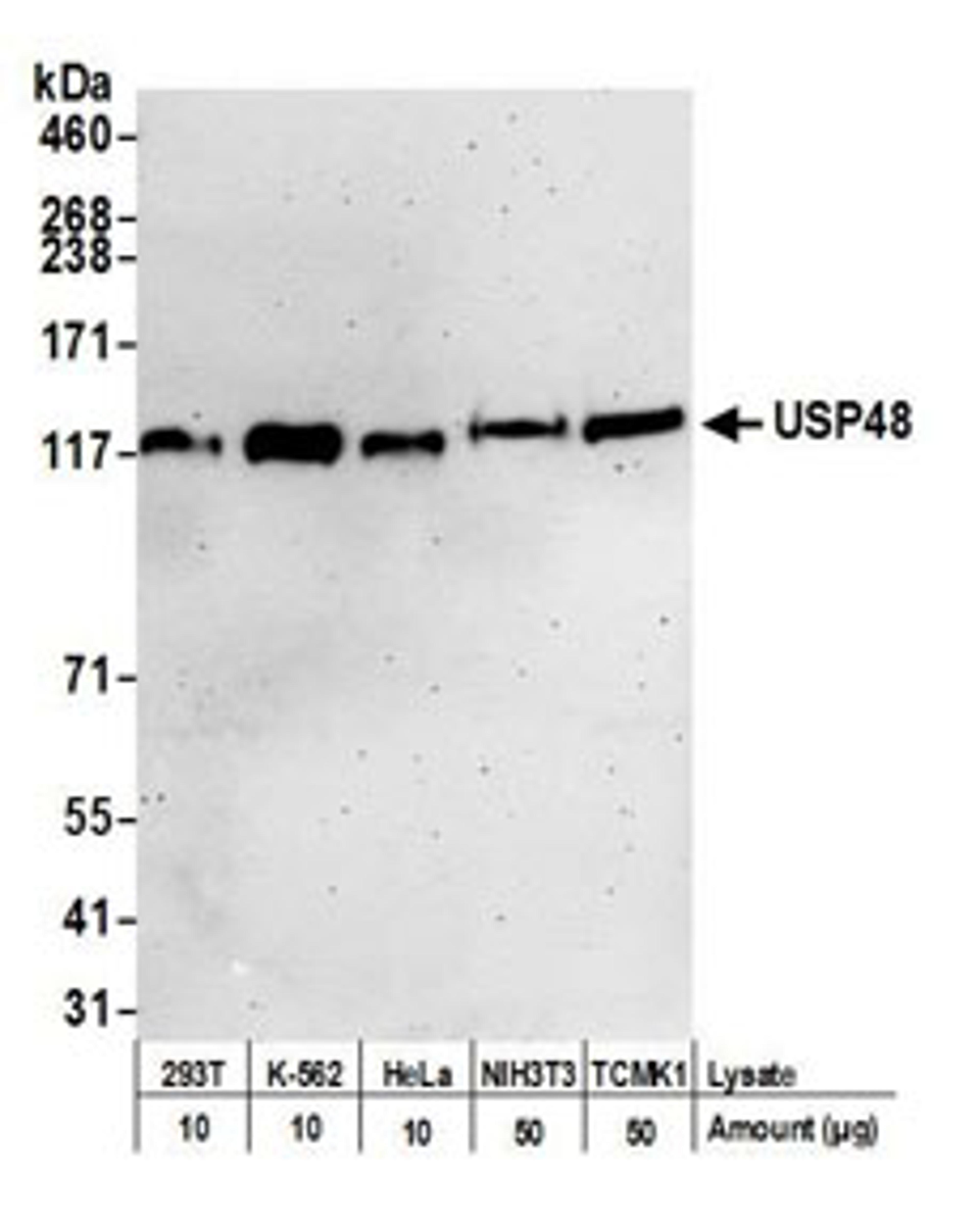 Detection of human USP48 by western blot.